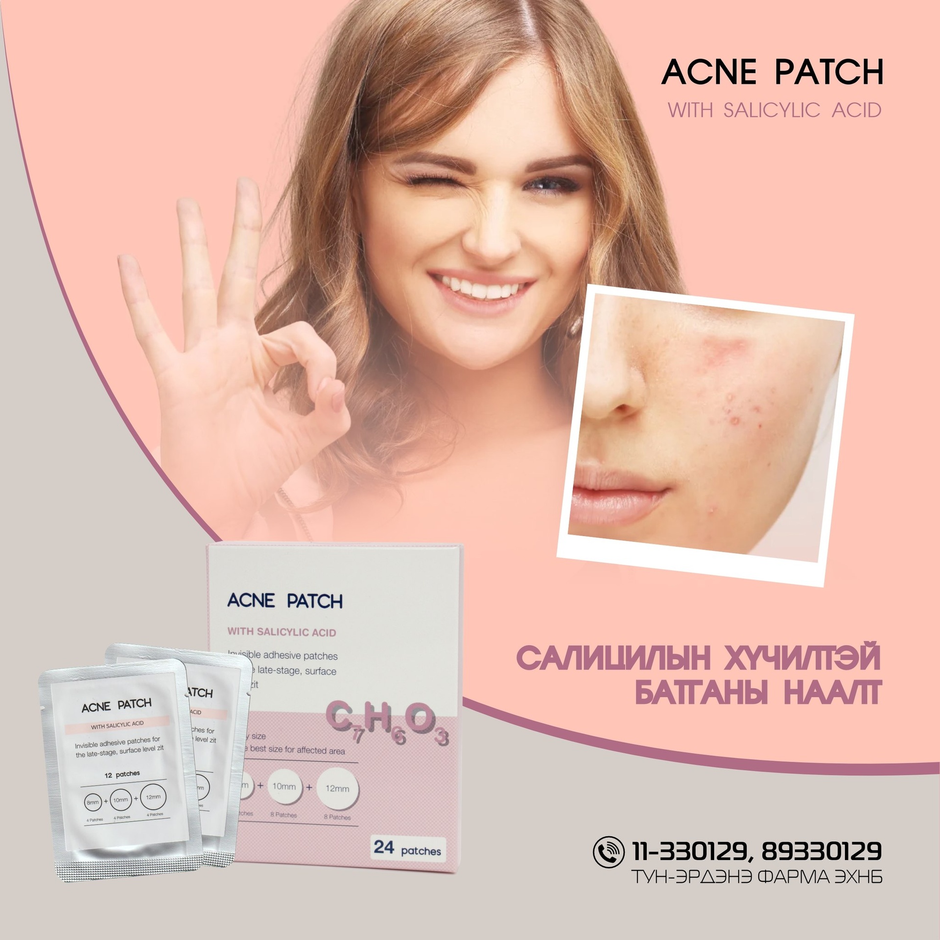 Батганы наалт №24 /салицилтай/-ParAid